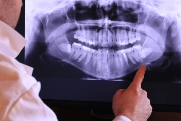 Best Cosmetic Emergency Dentistry in Lake Arrowhead, ME