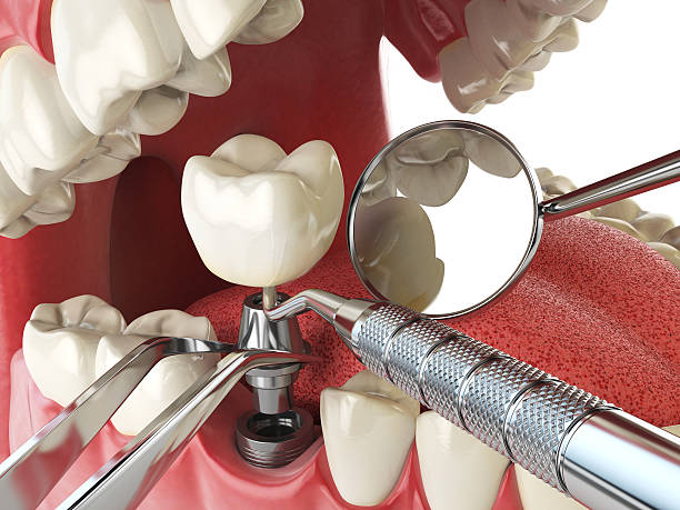 Best Emergency Gum Treatment in Lake Arrowhead, ME